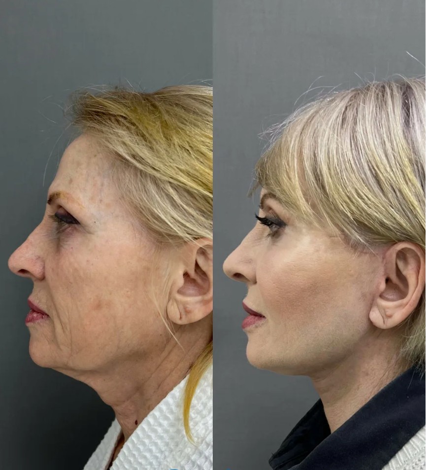 Anti-Aging-Therapy-Treatments-in-London-1