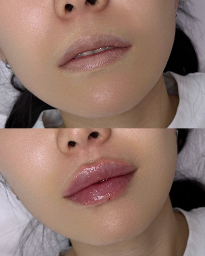 Stylage-Filler-in-London