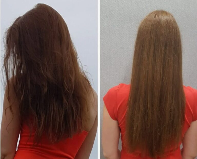 Non-surgical hair care solution using Hair Filler to enhance hair vitality and thickness.