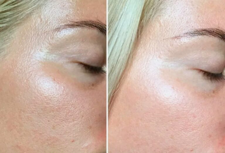 Premium facial experience with advanced Deluxe HydraFacial treatment.