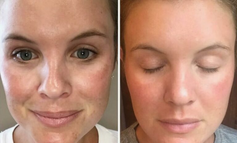 Lunch time Glow & Go Facial for fresh and radiant skin.