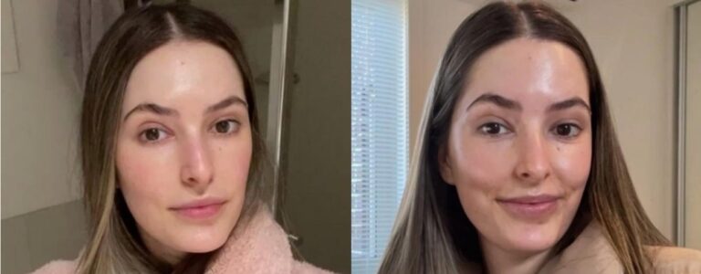 Skin refresh and healthy glow after Glow & Go Facial.