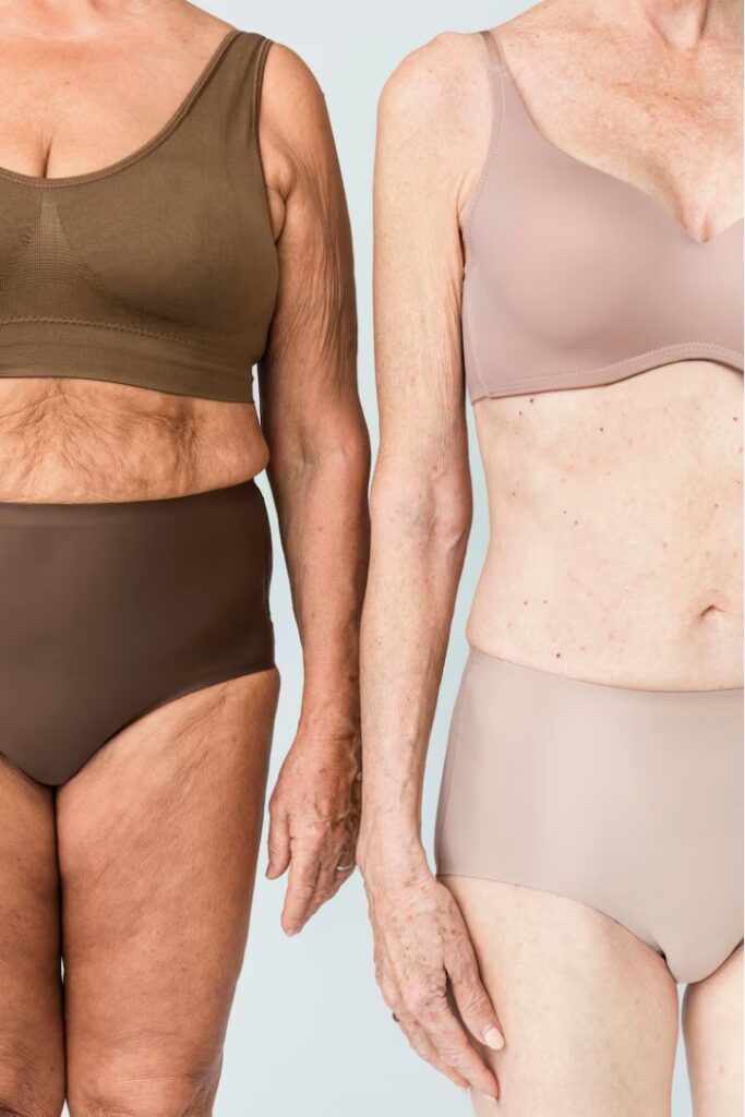 Sculptra Body Treatments designed to stimulate collagen and improve skin quality.