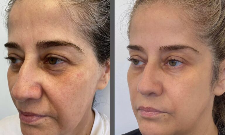 Targeted Skin Tightening & Saggy Skin Treatments for different body areas.