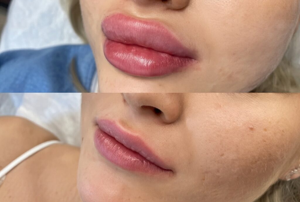 Before and After: The Dissolving Process and Recovery