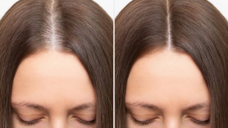 before-and-after-polynucleotides-hair-treatment-2