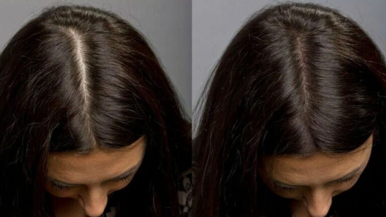 before-and-after-polynucleotides-hair-treatment-3