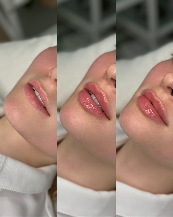 A portrait of the model's lips to describe the treatment process.