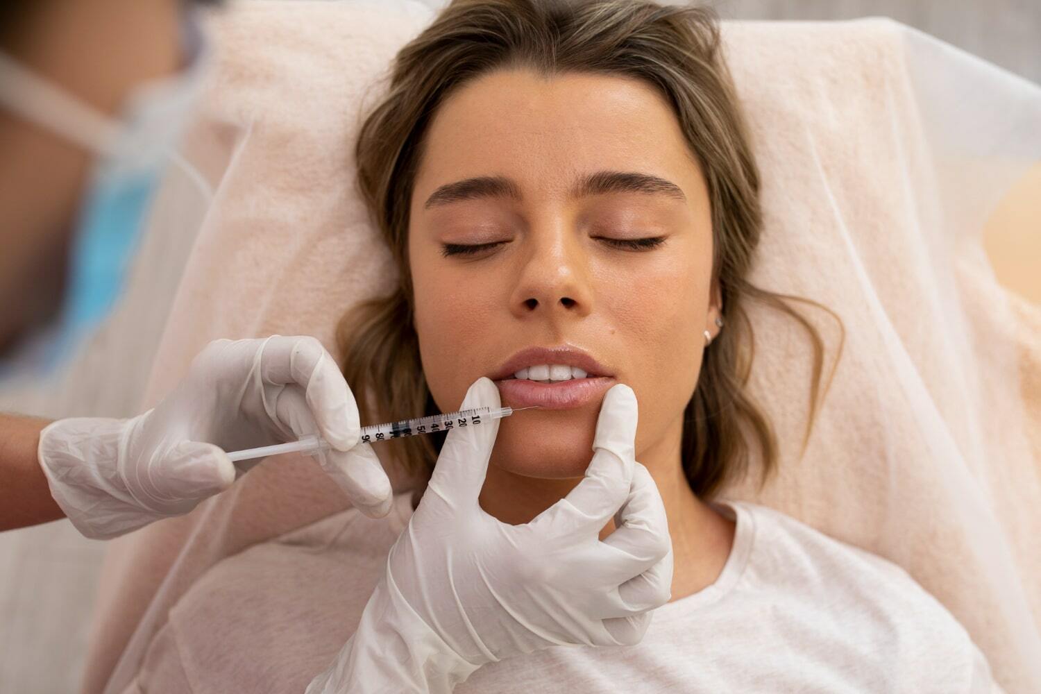 Lip Filler Treatments in City of London