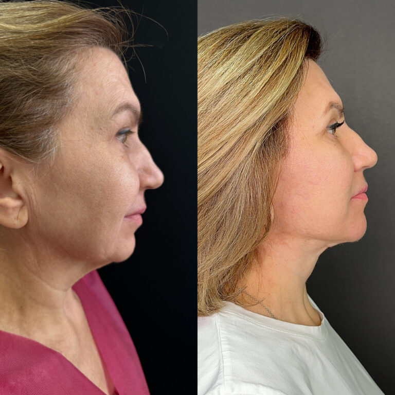 created by photogrid