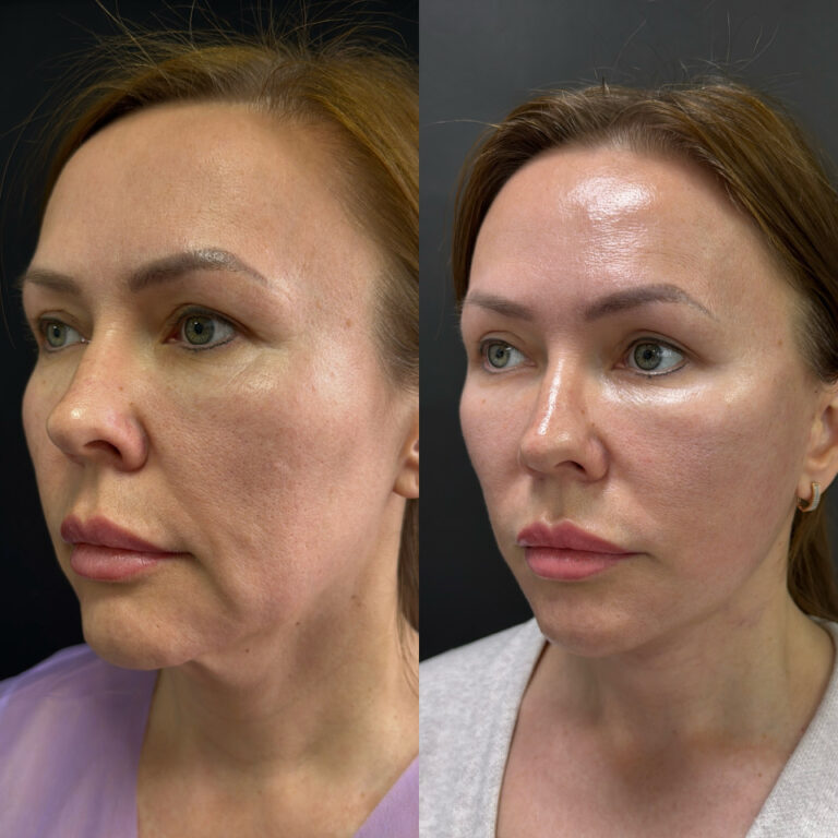 created by photogrid