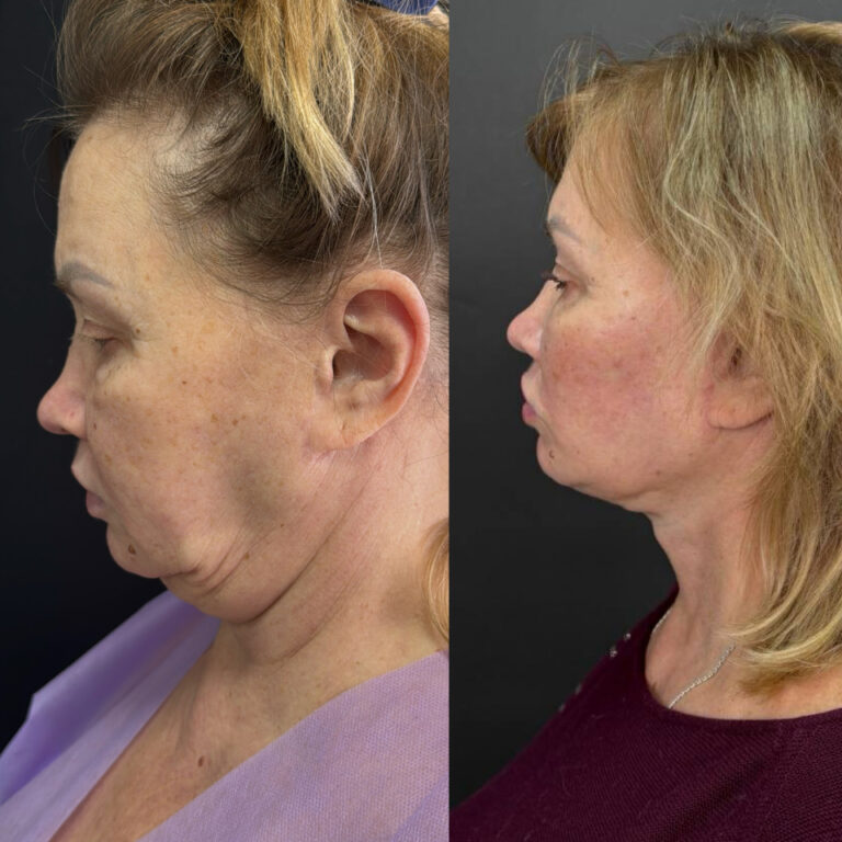 created by photogrid