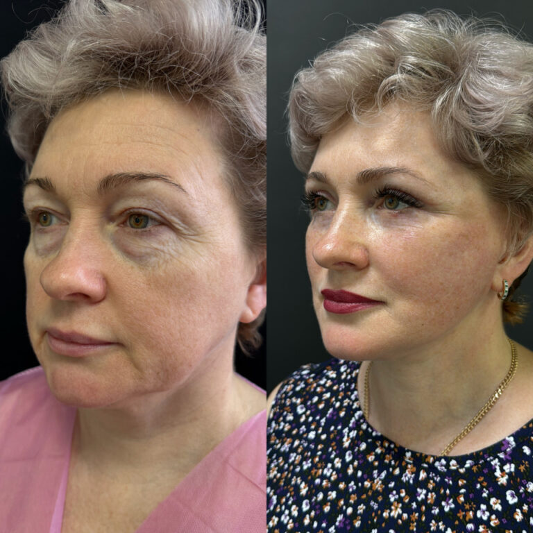 created by photogrid