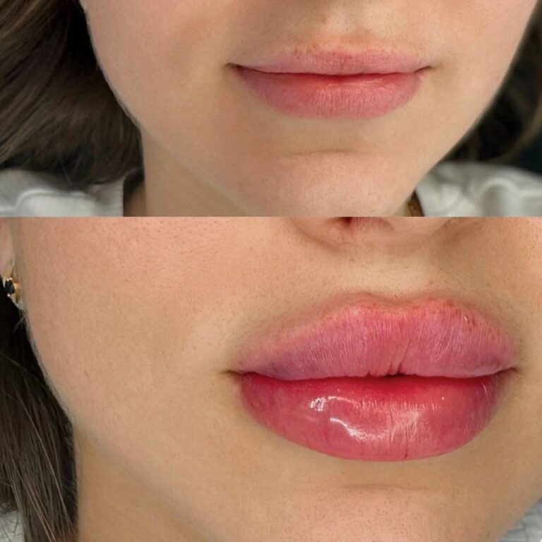 russian-lips-results-2