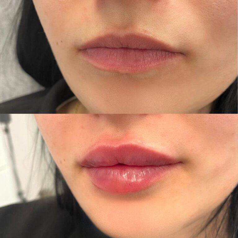 russian-lips-results-4
