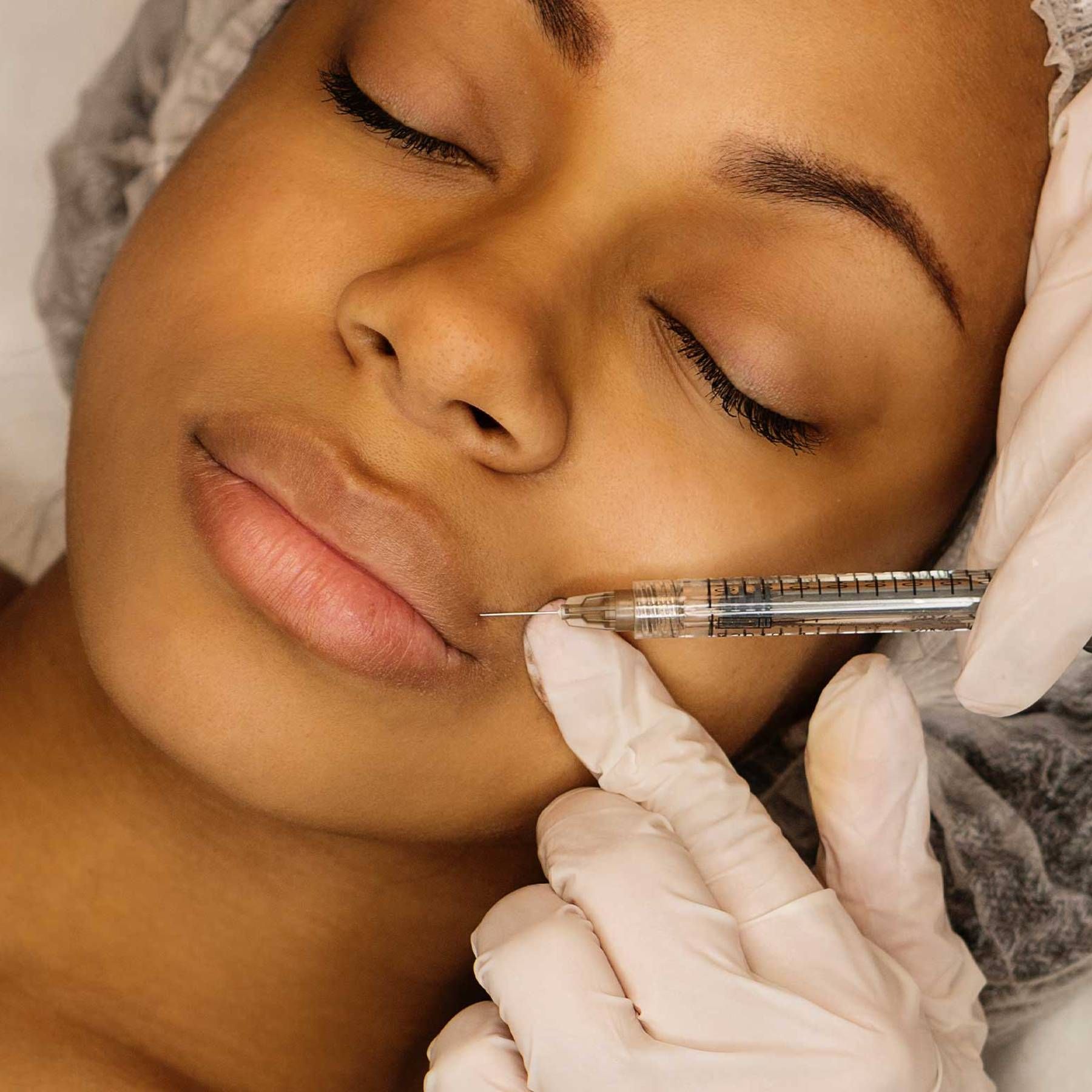 Lip Filler Treatment Procedure