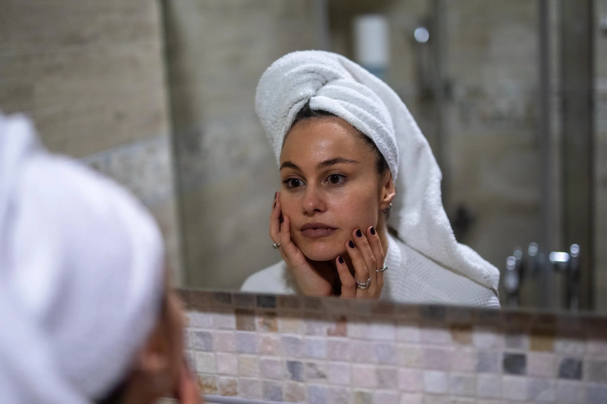 Essential Botox aftercare tips to support recovery and maintain optimal treatment results