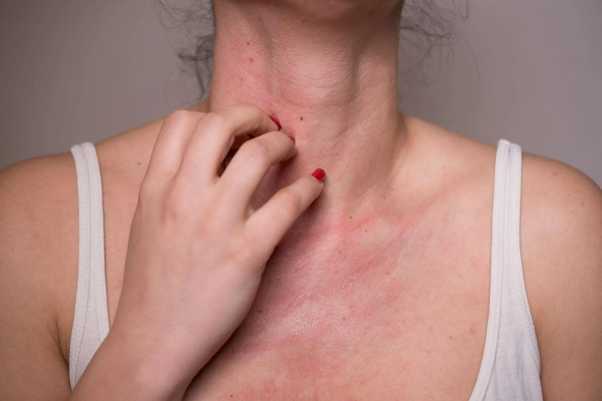 Symptoms of a true allergic reaction after Botox treatment including swelling, rash, or breathing difficulties