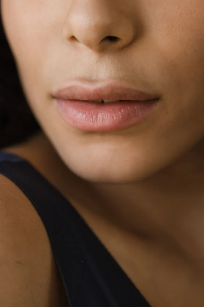 Close-up of lips with mild swelling after cosmetic lip filler injections