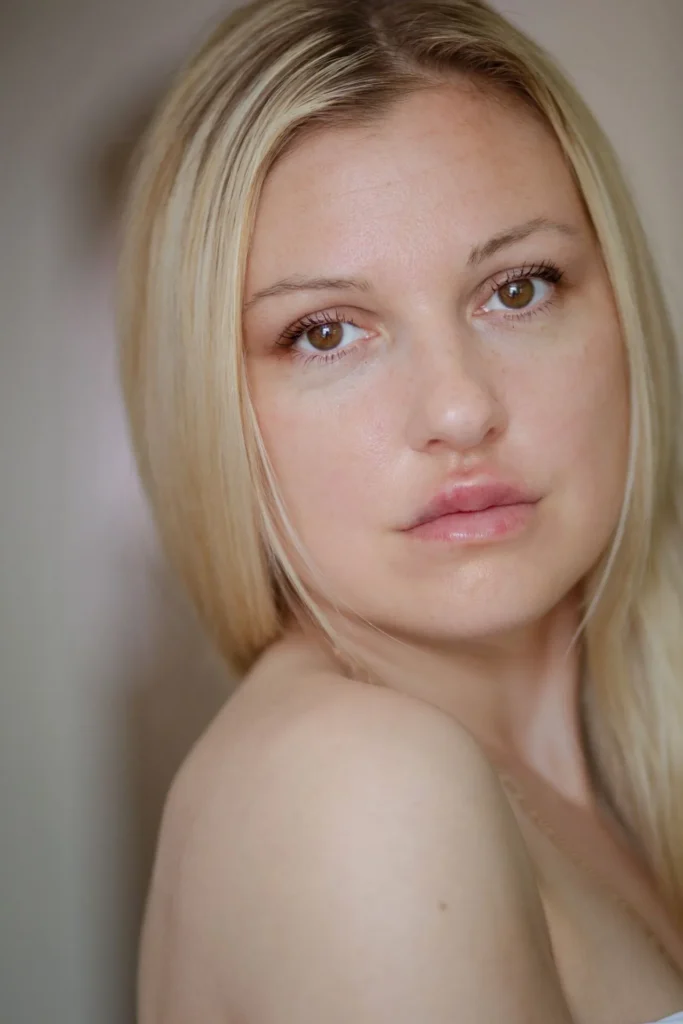 Benefits of Neauvia filler treatment
