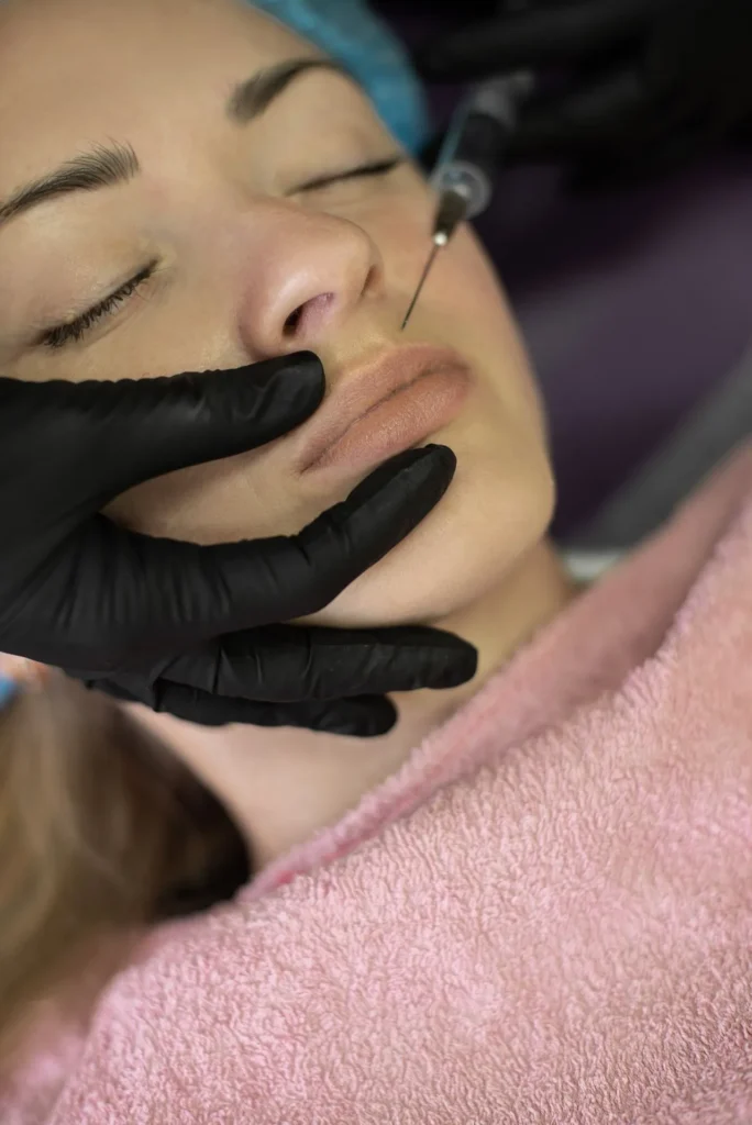 Cosmetic specialist performing a lip filler injection with a syringe