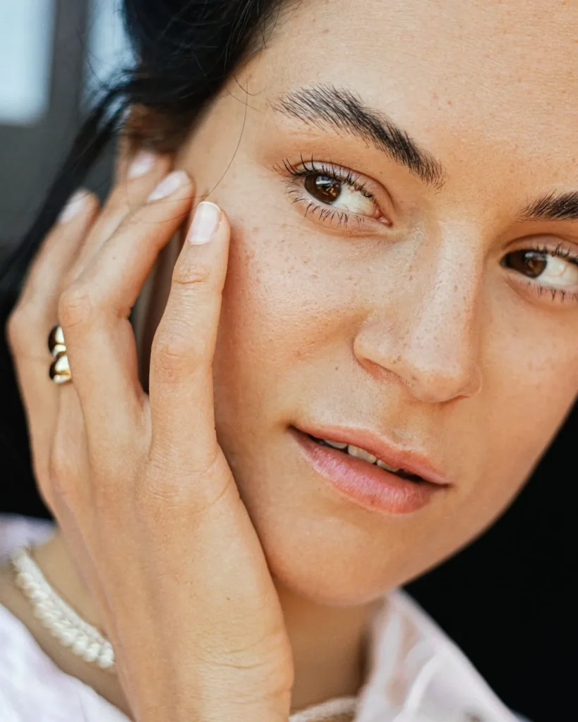 Healthy facial skin showing smoother nasolabial folds after filler treatment
