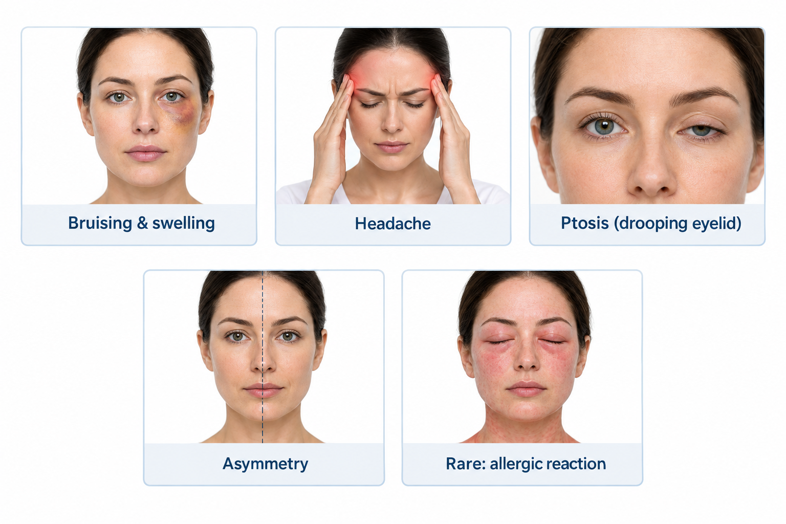 Fact cards showing common side effects of anti-wrinkle injections including bruising and ptosis