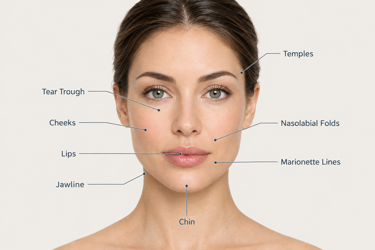 Infographic showing common dermal filler treatment areas on the face