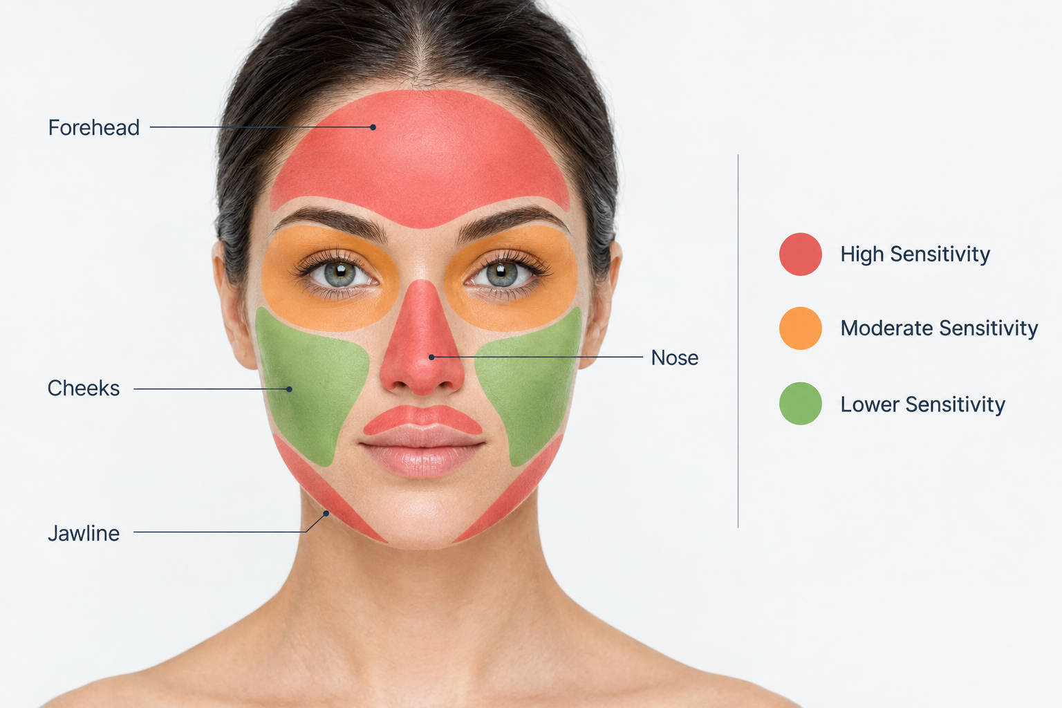 Face diagram showing microneedling pain sensitivity zones by treatment area