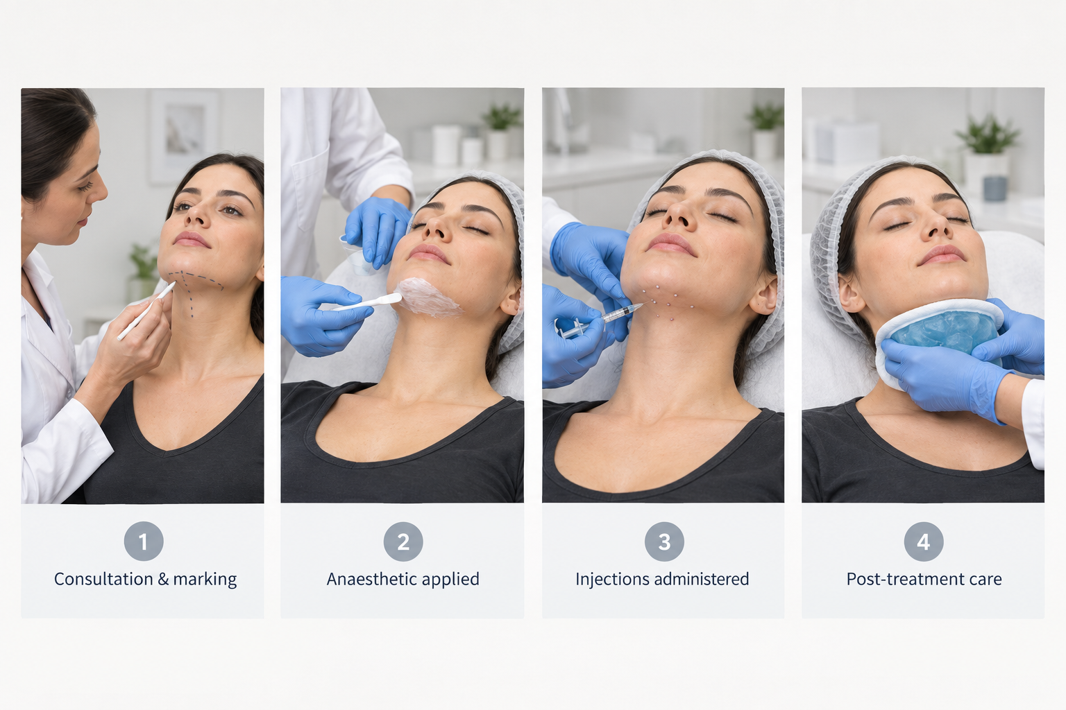 Step-by-step diagram of a chin fat dissolving injection treatment session