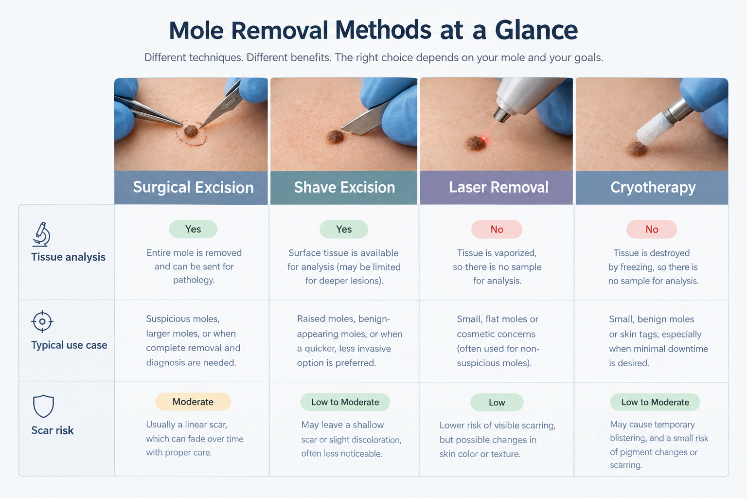 Comparison of clinical mole removal methods including excision laser and cryotherapy