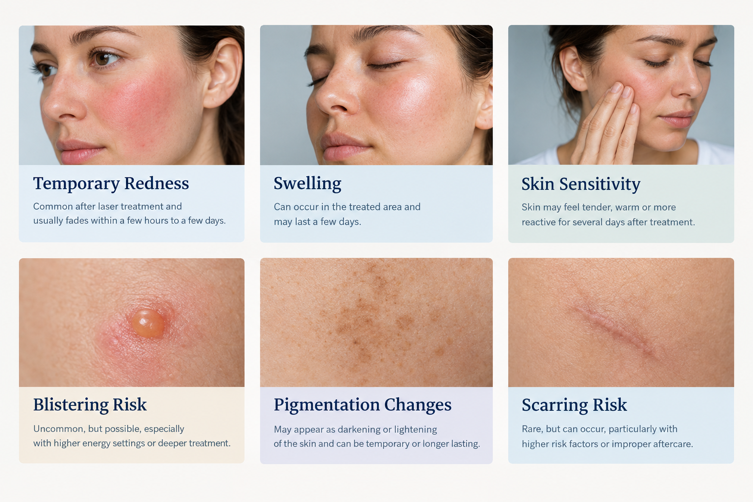 Fact cards listing common and serious side effects of laser skin treatments