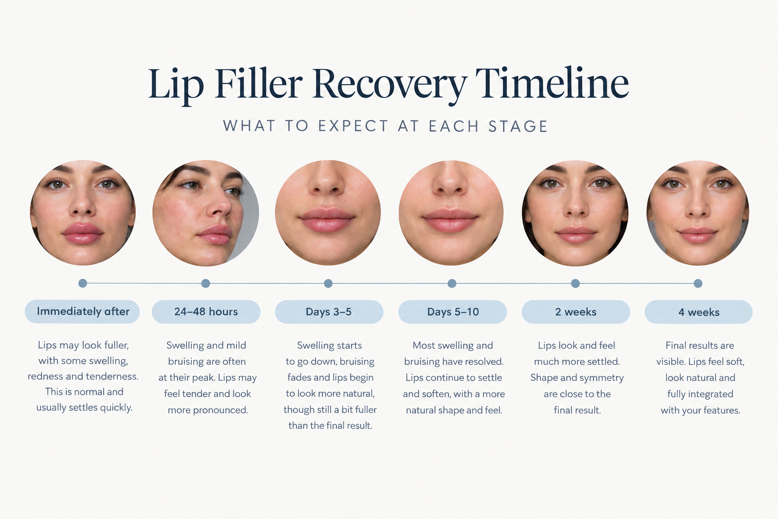 Lip filler recovery timeline chart from day one to four weeks post-treatment