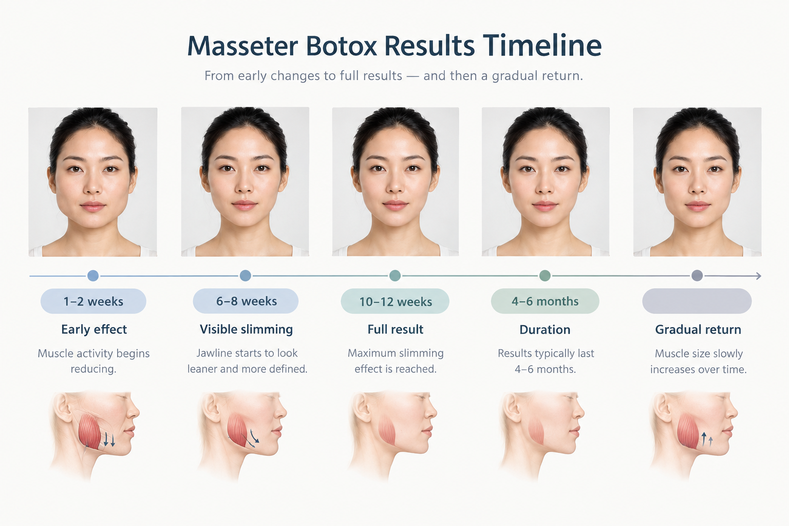 Timeline infographic showing masseter Botox results onset at 6 to 8 weeks and duration of 4 to 6