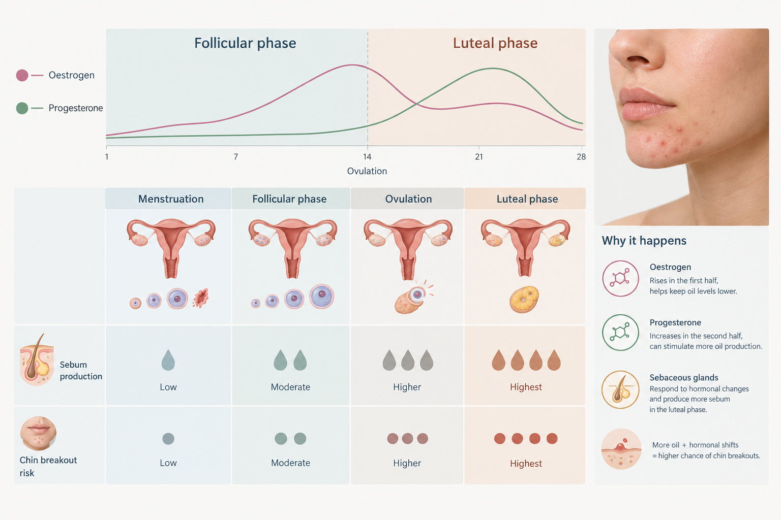 Infographic showing how hormonal fluctuations during the menstrual cycle contribute to chin