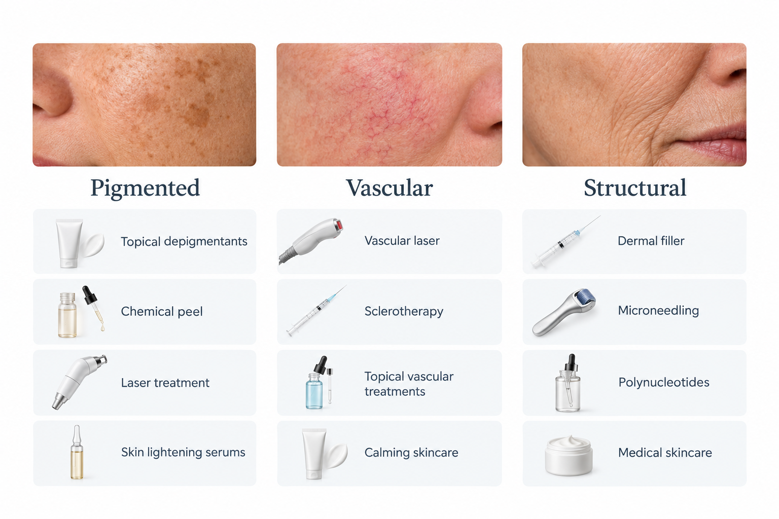 Comparison chart of treatment options for pigmented, vascular, and structural dark circles
